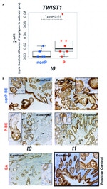 E-cadherin Antibody in Immunohistochemistry (Paraffin) (IHC (P))