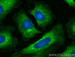 DZIP3 Antibody in Immunocytochemistry (ICC/IF)