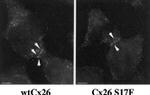 Connexin 26 Antibody in Immunocytochemistry (ICC/IF)