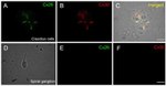 Connexin 30 Antibody in Immunocytochemistry (ICC/IF)