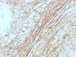 Tenascin C (Stromal Marker for Epithelial Malignancy) Monoclonal Antibody (T2H5)