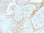 Tenascin C (Stromal Marker for Epithelial Malignancy) Monoclonal Antibody (SPM319)