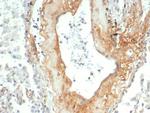 Tenascin C (Stromal Marker for Epithelial Malignancy) Monoclonal Antibody (TNC/4805)