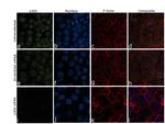 p300 Antibody in Immunocytochemistry (ICC/IF)