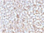 Apolipoprotein B /APOB Monoclonal Antibody (APOB, 3300)