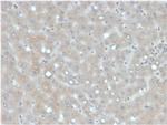 Apolipoprotein B /APOB Monoclonal Antibody (APOB, 4333)