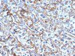 CD54/ICAM-1 Antibody in Immunohistochemistry (Paraffin) (IHC (P))