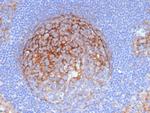 CD54/ICAM-1 Antibody in Immunohistochemistry (Paraffin) (IHC (P))