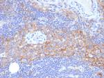 CD54/ICAM-1 Antibody in Immunohistochemistry (Paraffin) (IHC (P))