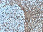 CD50/ICAM3 Monoclonal Antibody (ICAM3, 1019)