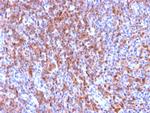 CD50/ICAM3 Recombinant Rabbit Monoclonal Antibody (ICAM3, 2873R)