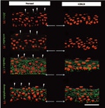 ZO-1 Antibody in Immunocytochemistry (ICC/IF)