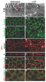 ZO-1 Antibody in Immunocytochemistry (ICC/IF)