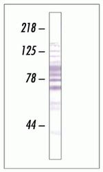 SR Monoclonal Antibody (16H3 (16H3E8))