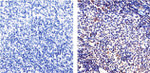 NFkB p65 Antibody in Immunohistochemistry (Paraffin) (IHC (P))