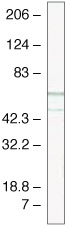 TCF4 Antibody in Western Blot (WB)