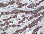 Prolactin Receptor Antibody in Immunohistochemistry (IHC)