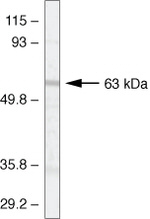 P2Y1 Polyclonal Antibody
