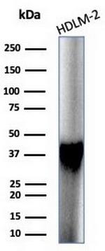 STING1/TMEM173 Antibody in Western Blot (WB)