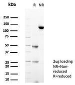 STING1/TMEM173 Antibody in SDS-PAGE (SDS-PAGE)