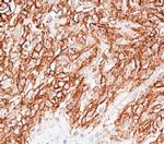 DOG1 Antibody in Immunohistochemistry (Paraffin) (IHC (P))