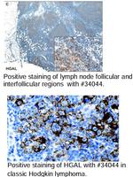 HGAL Antibody in Immunohistochemistry (Paraffin) (IHC (P))