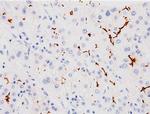 BSEP Antibody in Immunohistochemistry (Paraffin) (IHC (P))