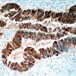 CDX-2 Antibody in Immunohistochemistry (Paraffin) (IHC (P))