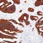 Cytokeratin 18 Antibody in Immunohistochemistry (Paraffin) (IHC (P))