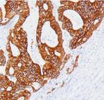 Cytokeratin 19 Antibody in Immunohistochemistry (Paraffin) (IHC (P))