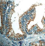 Nerve Growth Factor Receptor (NGFR) Antibody in Immunohistochemistry (Paraffin) (IHC (P))