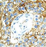 PD-L1 Antibody in Immunohistochemistry (Paraffin) (IHC (P))
