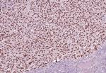 SOX-10 Antibody in Immunohistochemistry (Paraffin) (IHC (P))