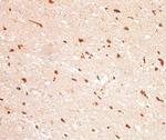 IDH1 Antibody in Immunohistochemistry (Paraffin) (IHC (P))