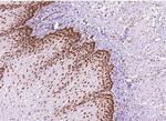 MLH1 Antibody in Immunohistochemistry (Paraffin) (IHC (P))