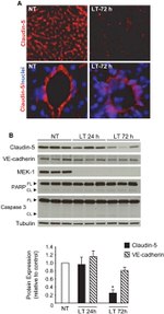 Claudin 5 Antibody in Western Blot, Immunocytochemistry (WB, ICC/IF)