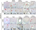 Claudin 5 Antibody in Immunohistochemistry (IHC)