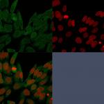 IDH1 (Isocitrate Dehydrogenase) Monoclonal Antibody (IDH1/1152)
