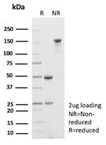 IDH1-R132G (Isocitrate Dehydrogenase) Antibody in SDS-PAGE (SDS-PAGE)