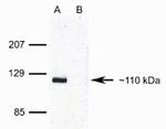 Phospho-Rb (Ser608) Antibody in Western Blot (WB)