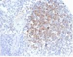 Interferon alpha Monoclonal Antibody (IFNA/6689)