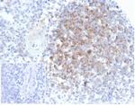Interferon alpha Monoclonal Antibody (IFNA/6689)