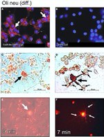 Connexin 29 Antibody in Immunocytochemistry (ICC/IF)