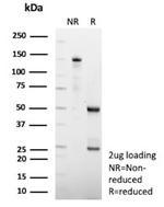 HSD17B13/Hydroxysteroid 17-beta dehydrogenase 13 Monoclonal Antibody (HSD17B13/13101)