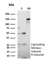 HSD17B13/Hydroxysteroid 17-beta dehydrogenase 13 Monoclonal Antibody (HSD17B13/13104)
