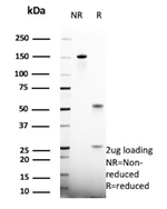 HSD17B13/Hydroxysteroid 17-beta dehydrogenase 13 (NAFLD/NASH Marker) Antibody in SDS-PAGE (SDS-PAGE)