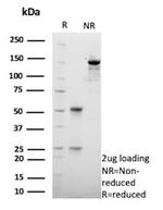 HSD17B13/Hydroxysteroid 17-beta dehydrogenase 13 Monoclonal Antibody (HSD17B13/13106)
