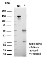 HSD17B13/Hydroxysteroid 17-beta dehydrogenase 13 (NAFLD/NASH Marker) Antibody in SDS-PAGE (SDS-PAGE)