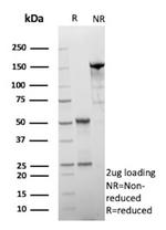 HSD17B13/Hydroxysteroid 17-beta dehydrogenase 13 Monoclonal Antibody (HSD17B13/13109)