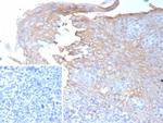 Interferon gamma (IFNG) Monoclonal Antibody (IFNG/9012)